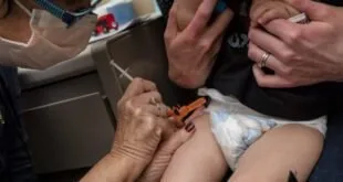 Convulsões após vacina da COVID-19 em crianças