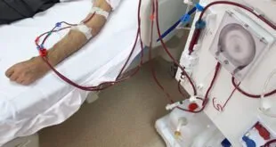 Hemodiálise Noturna: Lótus Nefrologia realiza tratamento inovador para pacientes renais