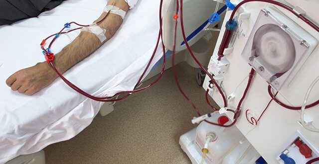 Hemodiálise Noturna: Lótus Nefrologia realiza tratamento inovador para pacientes renais