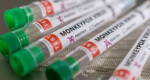 Suécia registra primeiro caso de mpox fora da África