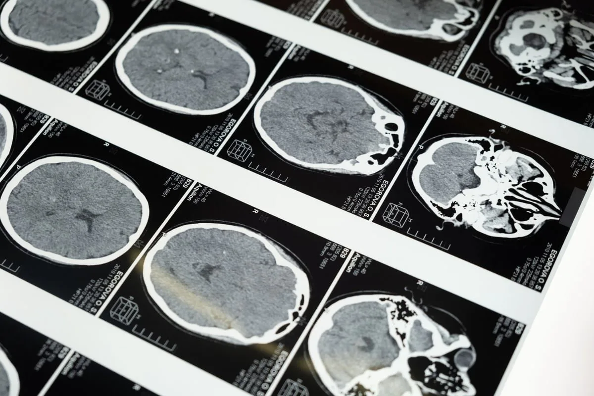 Médico neurologista analisando exame de imagem do cérebro humano em consultório