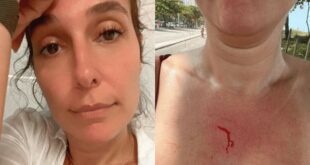 Natasha Dantas, esposa de Bonner, é roubada no RJ: “não sou culpada”
