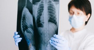 Aparelho de radiografia de tórax em referência ao Dia Nacional da Abreugrafia