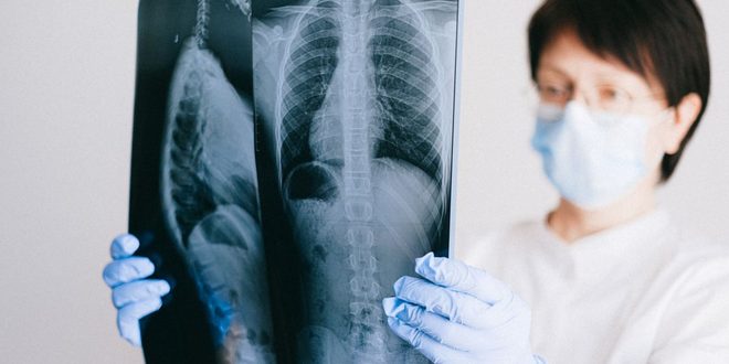 Aparelho de radiografia de tórax em referência ao Dia Nacional da Abreugrafia