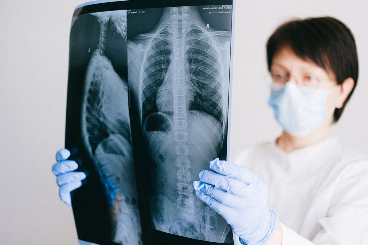 Aparelho de radiografia de tórax em referência ao Dia Nacional da Abreugrafia