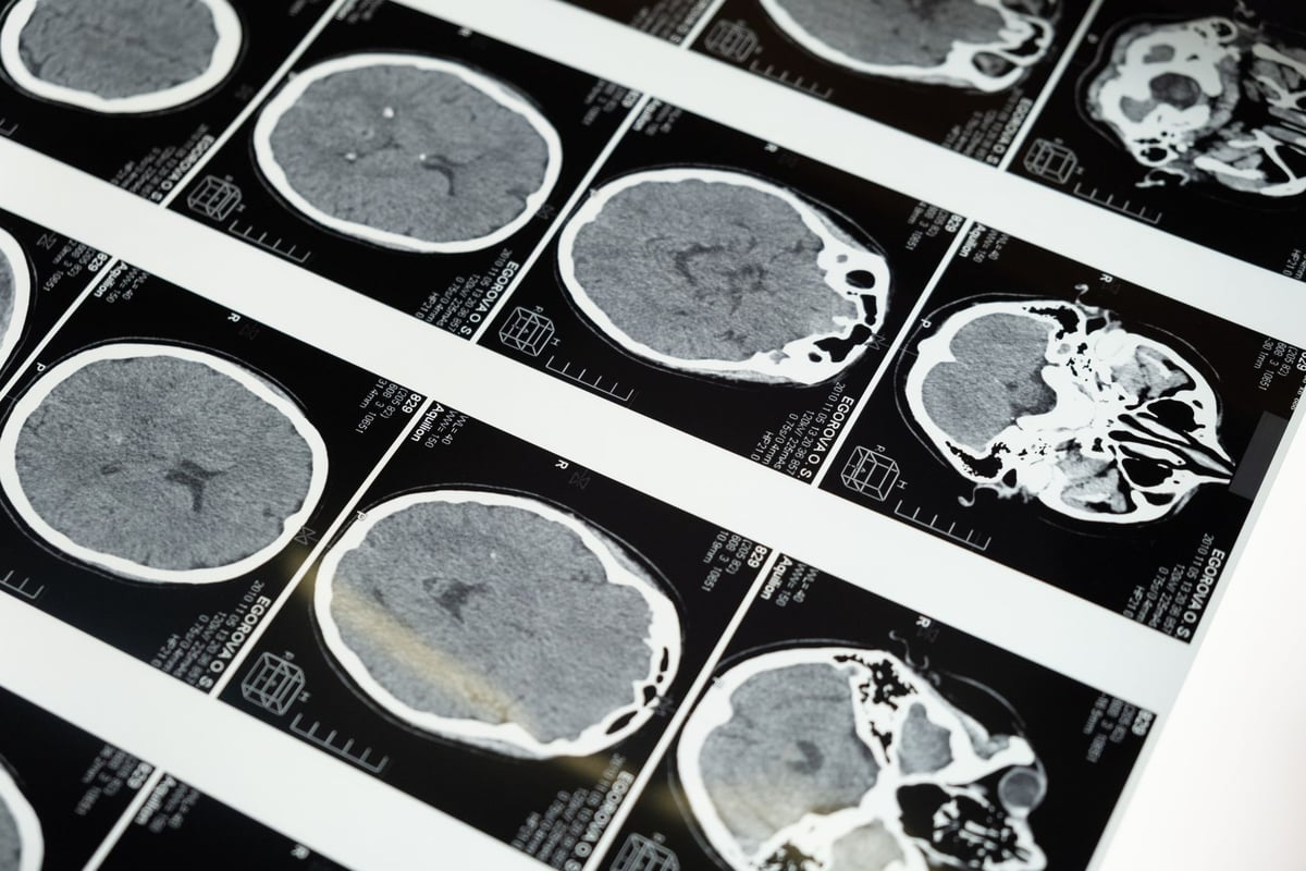 Médico neurologista analisando exame de imagem do cérebro humano em consultório
